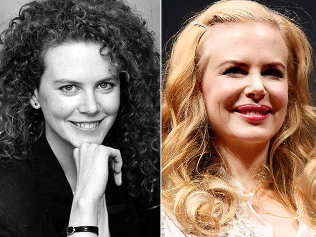 nicole-kidman-10-beaut-s-qui-ont-exag-r-avec-le-bistouri-hitparades-fr